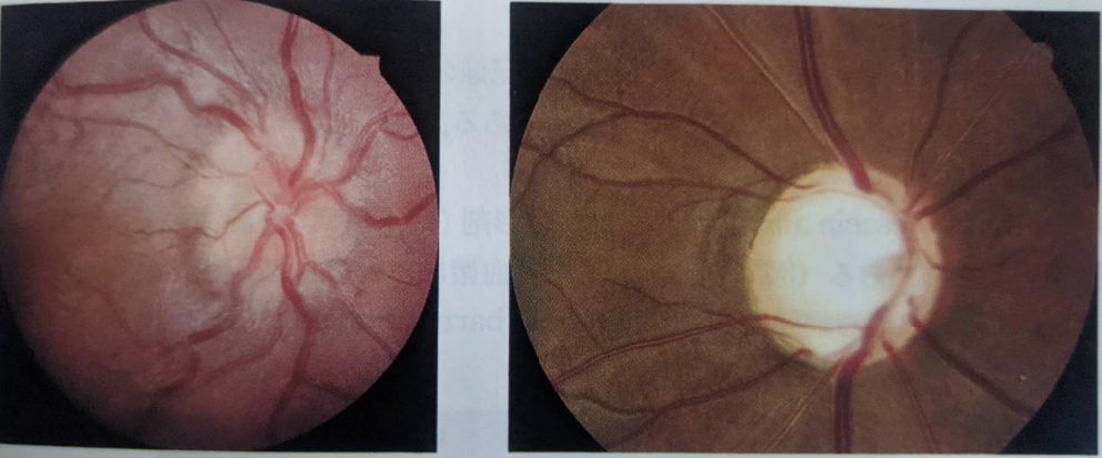 この状態の原因は何ですか?